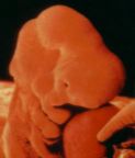 3. Semana

El embri�n posee un coraz�n en forma de 