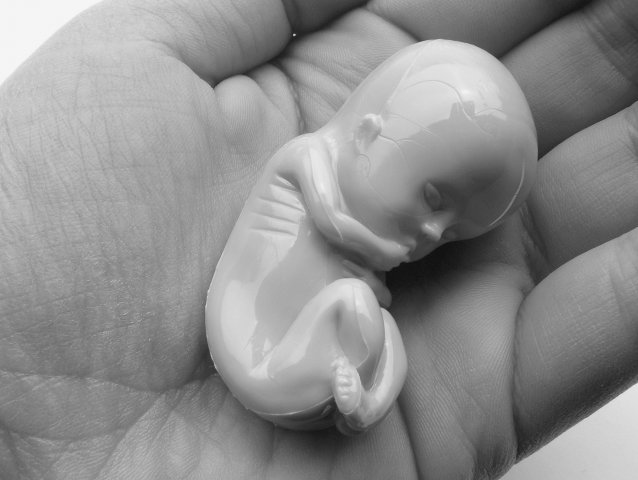 embrión - aborto