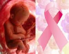 Secuela del aborto: cáncer de mama