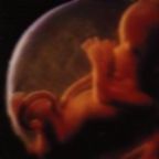 14. - 17. Week

El foetus,conception,life,prolife,murder,abortion, mueve la cabeza, los brazos, las piernos y los labios. Los ojos y los o�dos han alcanzdo  su lugar definitivo. La circulaci�n est� perfecta.
