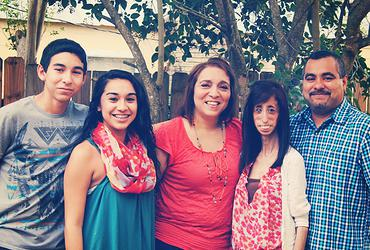 Lizzie Velasquez la mujer más fea del mundo con su familia